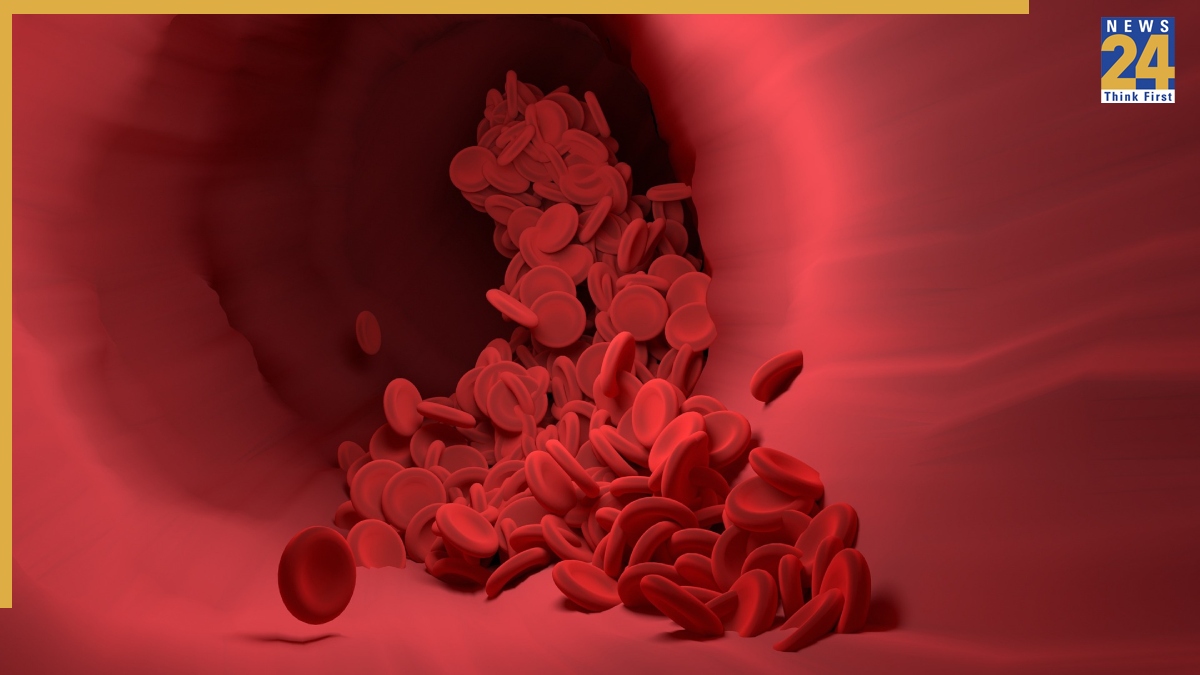 Khun Ki Kami Kaise Dur Kare Ghar Par-1