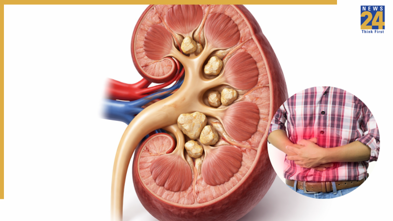Kidney Cancer Symptoms