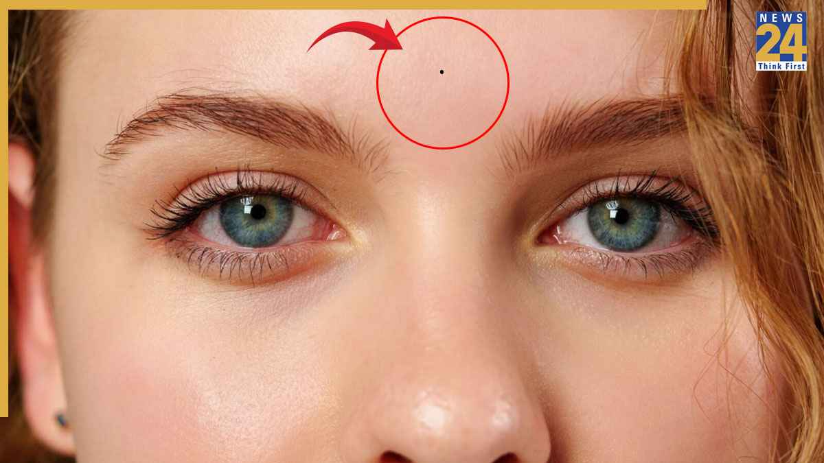 Mole On Third Eye