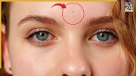 Mole On Third Eye