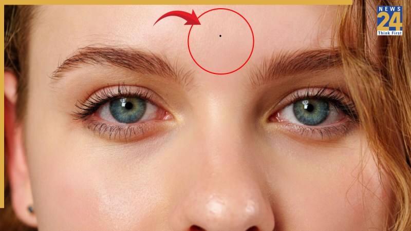 Mole On Third Eye
