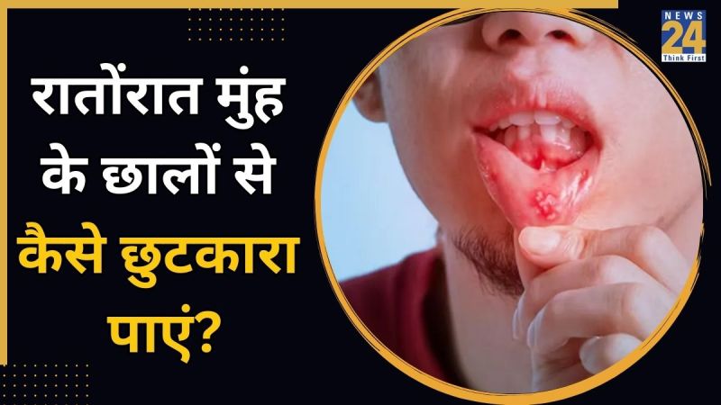 Mouth Sores Home Remedies