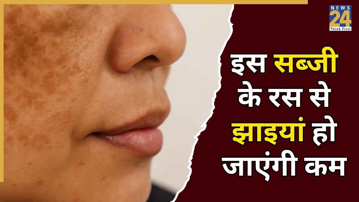 Pigmentation Home Remedies