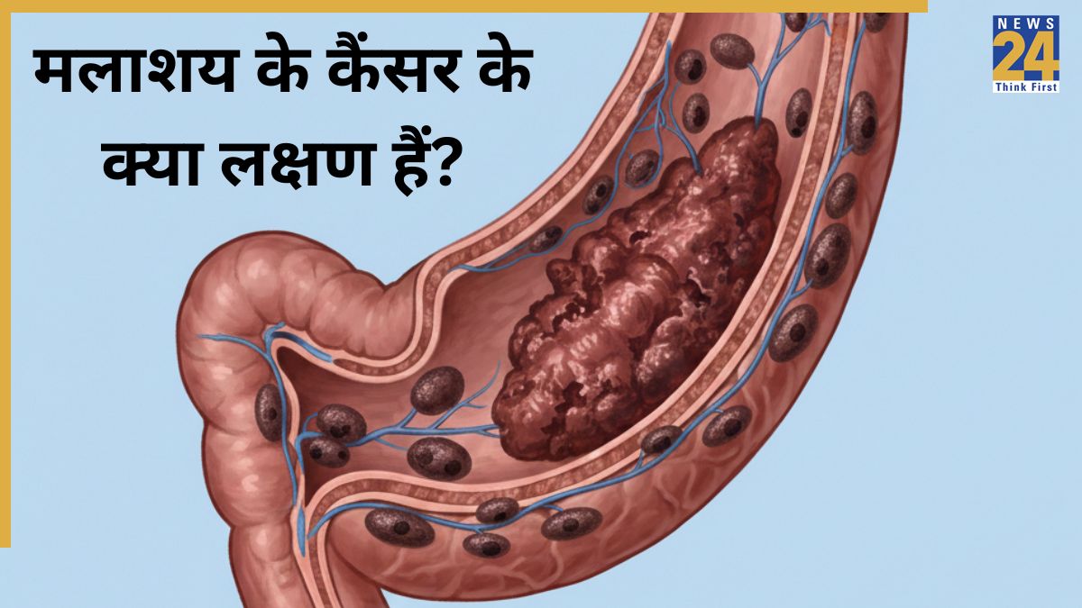 Rectal Cancer Symptoms-1