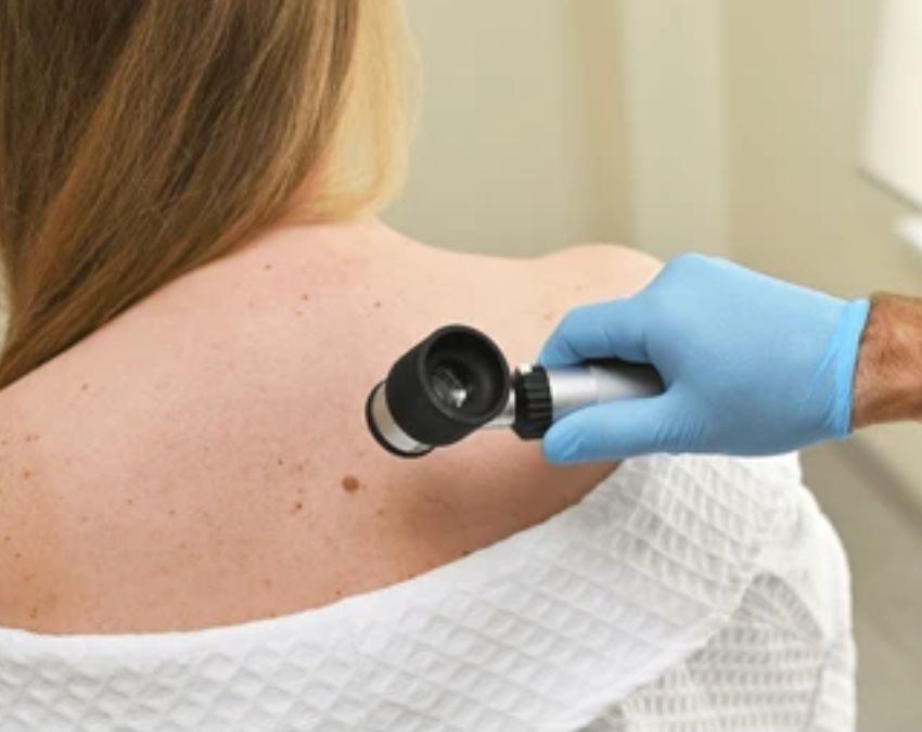 Skin Cancer Ke Lakshan Skin Cancer Ke Lakshan-1-2