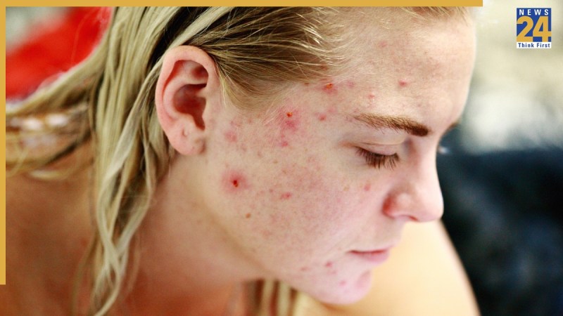 Skin Problem Solution Tips