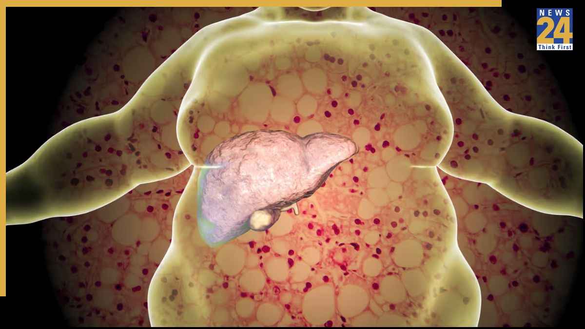 Liver Ko Healthy Rakhne Ke Liye Kya Kare