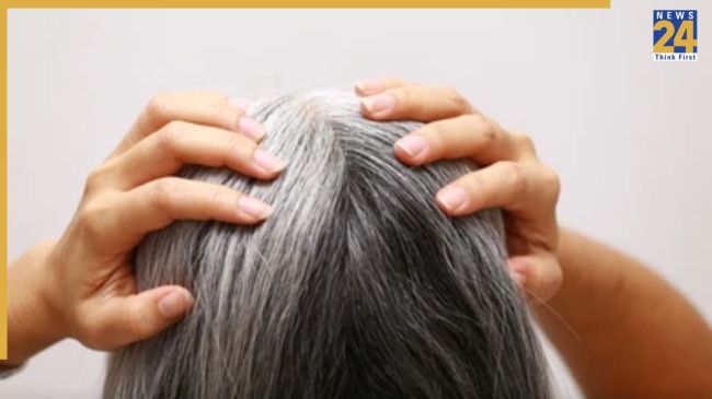 White Hair Home Remedies