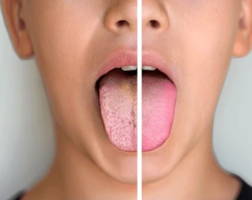 what causes the tongue to change colour-1-2