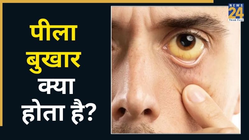 peela bukhar ke shuruati 5 lakshan