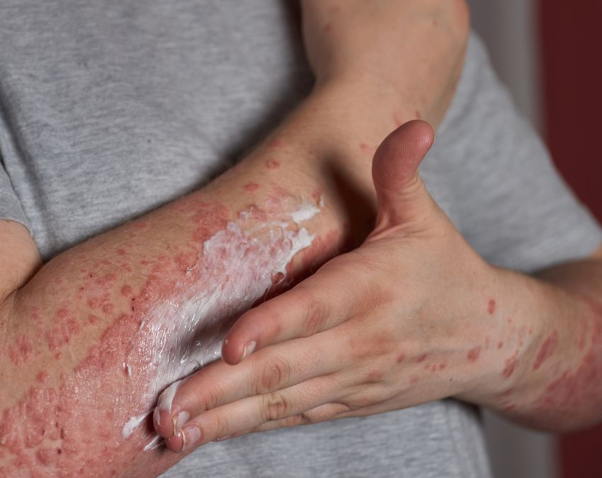 Sugar ke lakshan-1-2-3-4-5-6-7