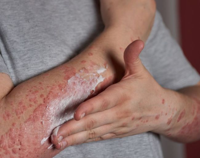 Sugar ke lakshan-1-2-3-4-5-6-7