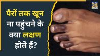 Blocked Arteries Symptoms In Legs