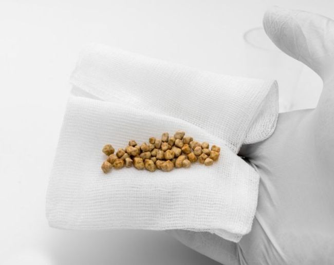 Pitte Ki Pathri Mein Dard Hona-1-2-3-4-5