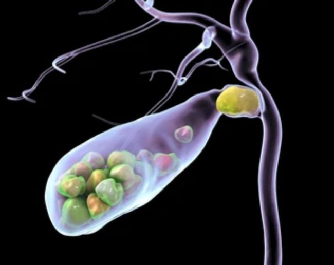 Pitte Ki Pathri Mein Dard Hona-1-2-3-4