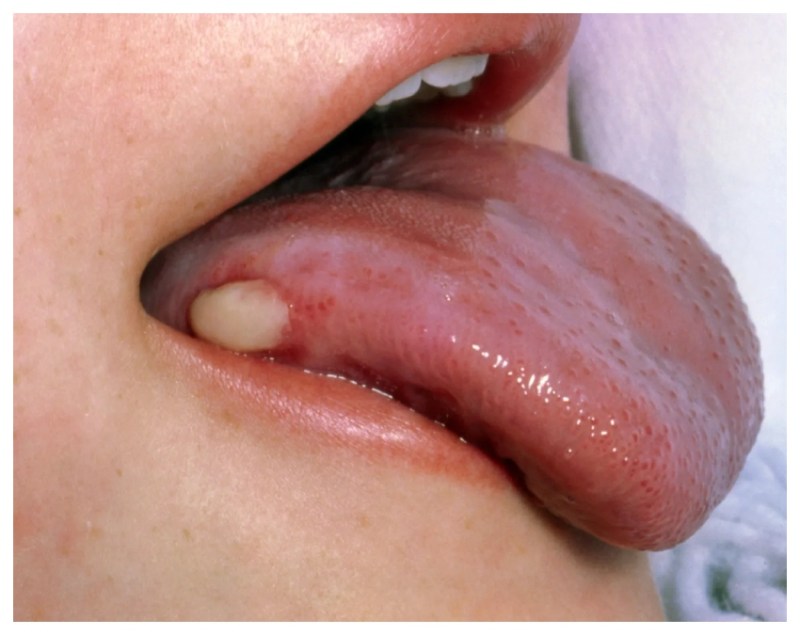 CANCER.jpg_f01a9a -1-2