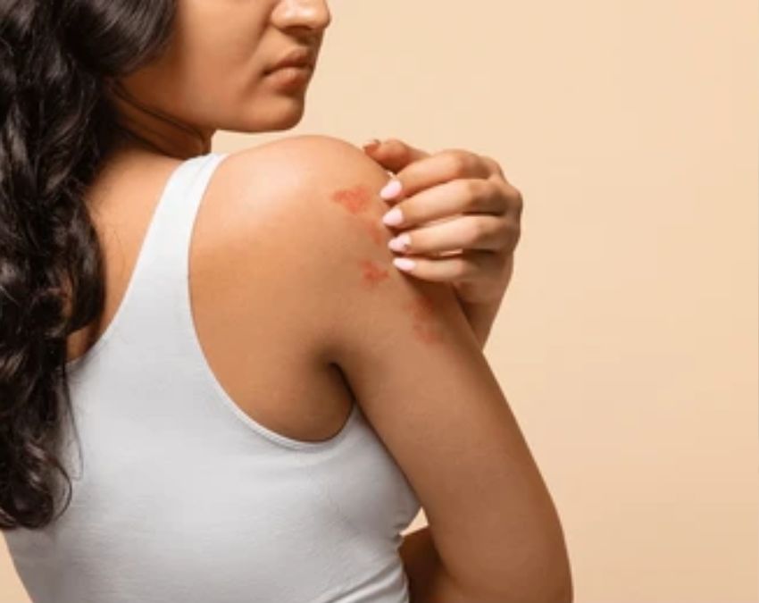 Skin Cancer Ke Lakshan Skin Cancer Ke Lakshan-1-2-3-4