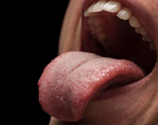 what causes the tongue to change colour-1-2-3-4-5-6