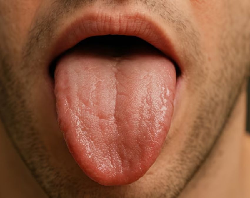 what causes the tongue to change colour-1-2-3-4-5