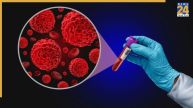 Blood Cancer Kiski Kami Se Hoti Hai