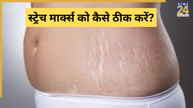 Pet Se Nishan Kaise Gayab Kare