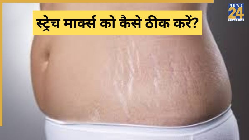 Pet Se Nishan Kaise Gayab Kare