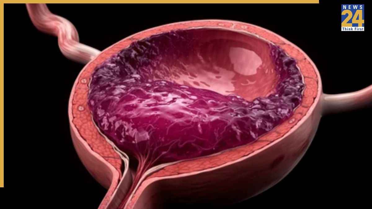 warning signs of bladder cancer warning signs of bladder cancer