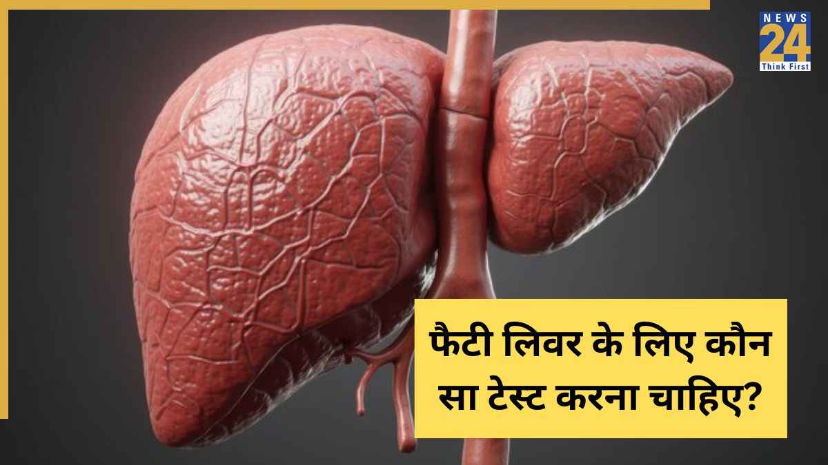 fatty liver test