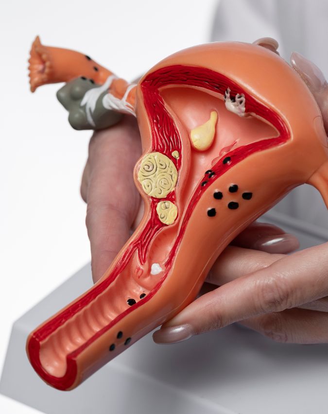 cervical cancer symptoms-1-2