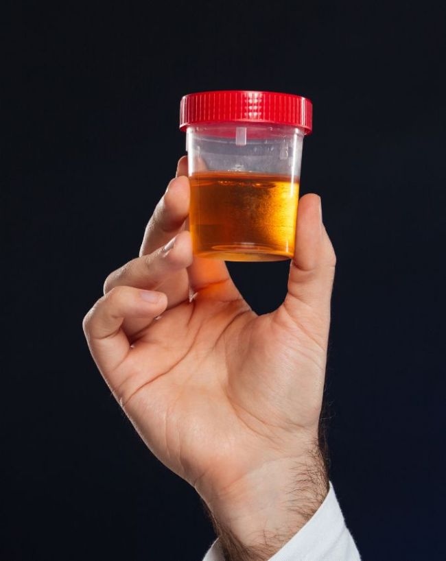 Blood in urine causes lal peshab-1-2-3-4-5