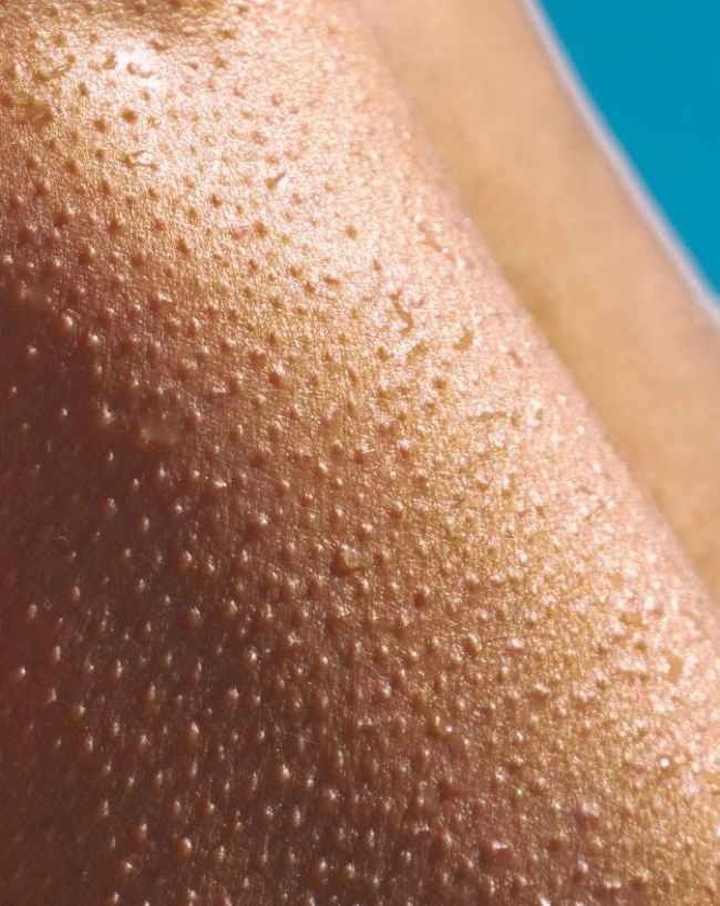 Rash And Bumps On Inner Thigh-1-2-3-4-5