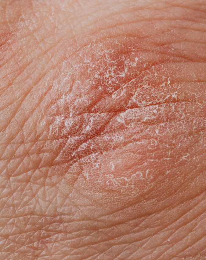 Diseases Caused Due To Drinking Less Water-1-2-3-4-5-6-7