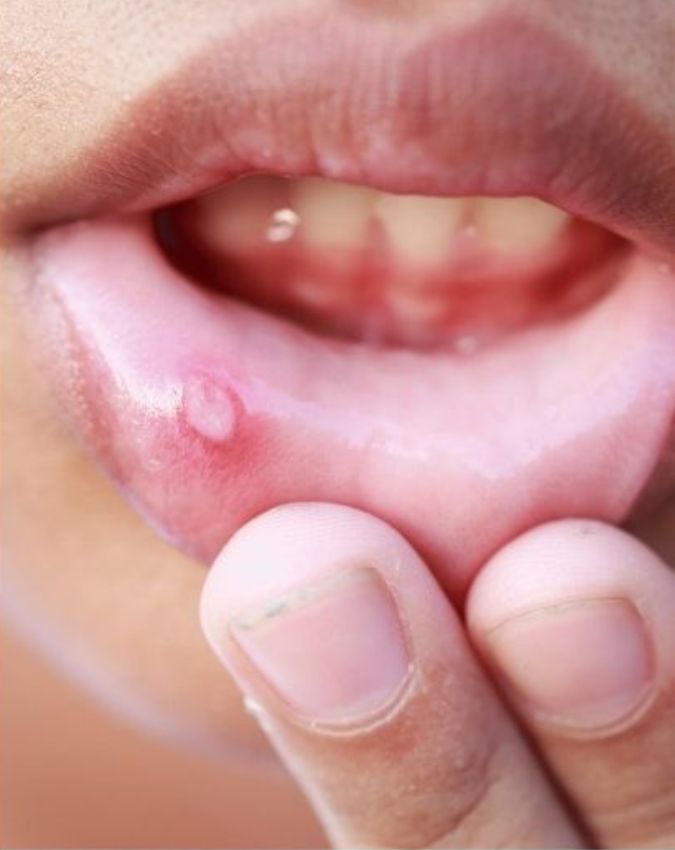 Cancer Lumps Symptoms-1-2-3-4-5-6-7