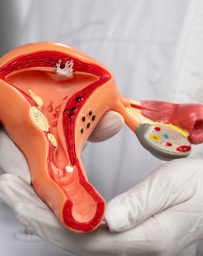 cervical cancer symptoms-1-2-3-4