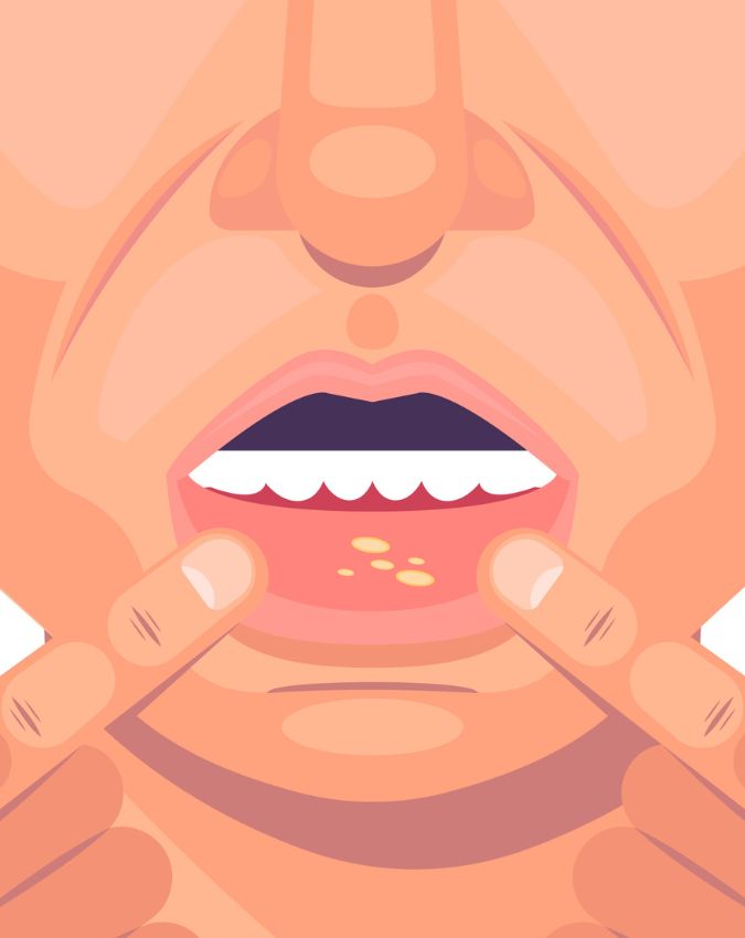 Muh Ke Cancer Ke Lakshan-1-2-3-4-5-6-7