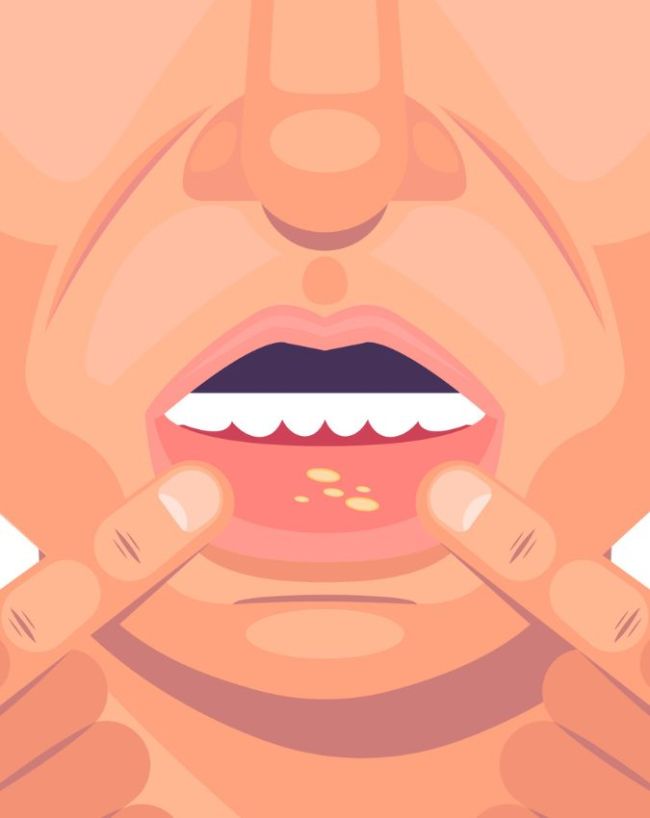 Muh Ke Cancer Ke Lakshan-1-2-3-4-5-6-7