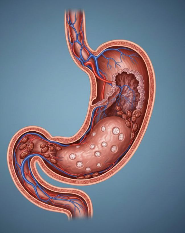 Pet Ke Cancer ke Lakshan-1-2