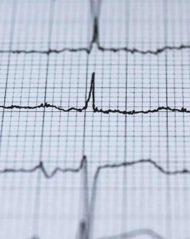 Low BP Symptoms-1-2-3-4-5-6-7-8