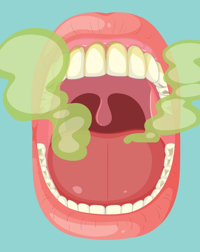 Mouth Cancer Symptoms-1-2-3-4-5-6