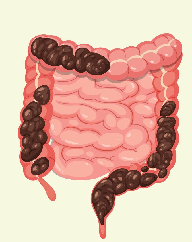 Aant Me Sujan Ke Lakshan-1-2-3