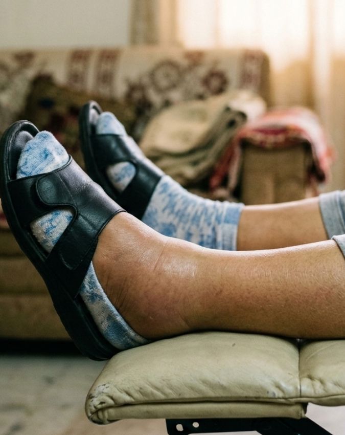 kidney Kharab Hone Ke Lakshan (6) kidney Kharab Hone Ke Lakshan (6)-1-2-3-4-5-6-7