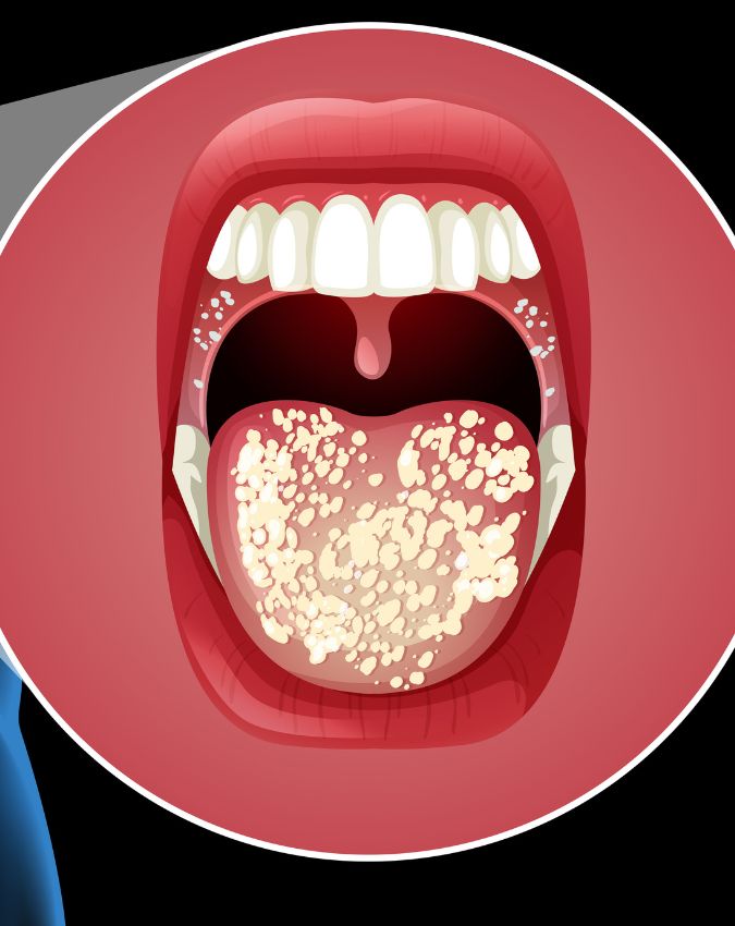 Vitamin ki kami se muh se badbu Vitamin ki kami se muh se badbu-1-2-3-4-5-6