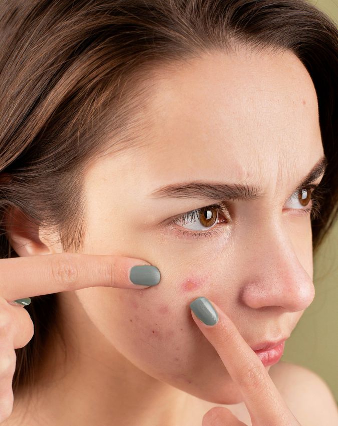 PCOD Symptoms In Hindi-1-2-3-4