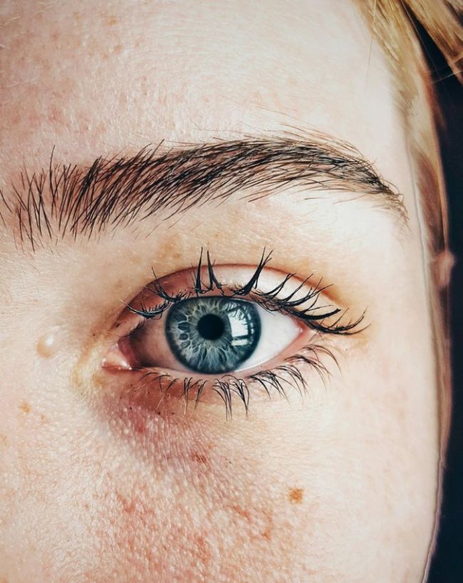 Low BP Symptoms-1-2-3-4-5