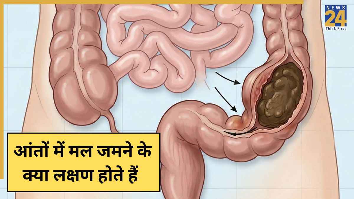 Aant Me Mal Jamne Ke Lakshan