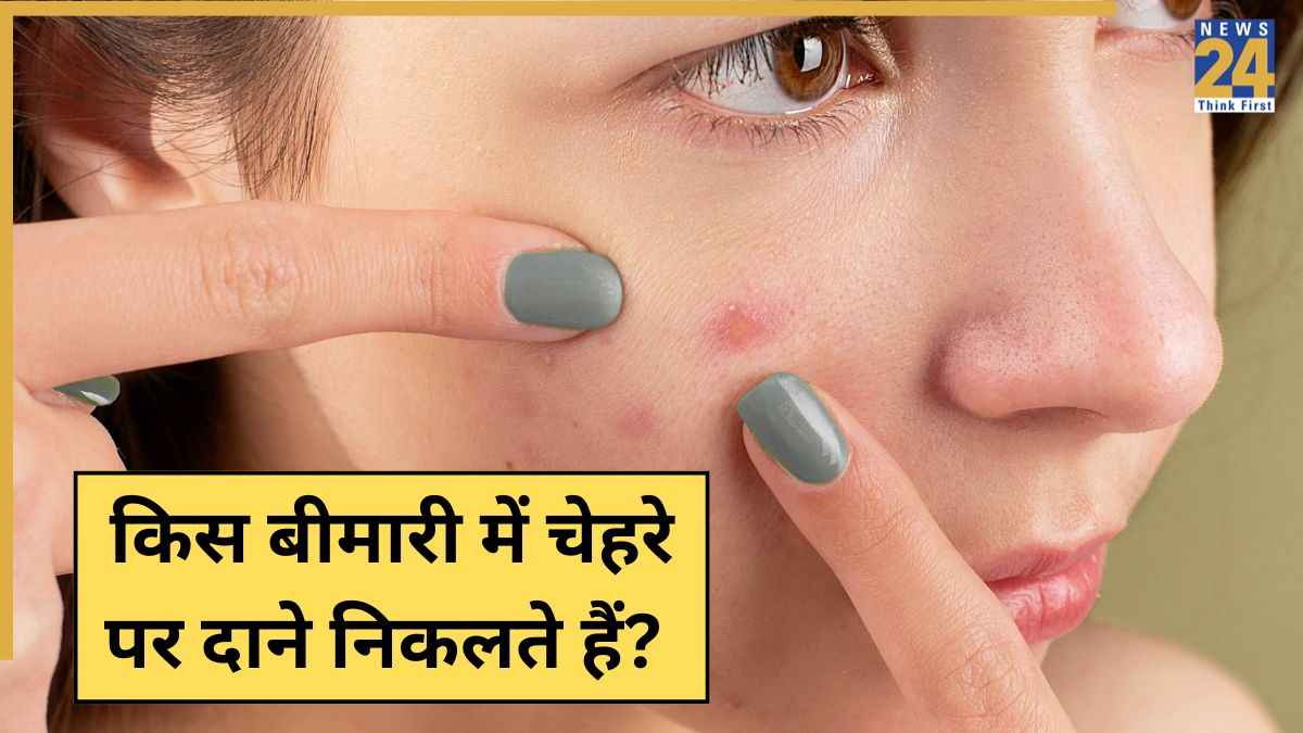किस बीमारी में चेहरे पर निकलते हैं दाने? बार-बार फुंसियां निकलें तो ना करें इग्नोर