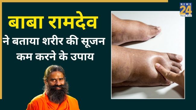 Home Remedies For Selling