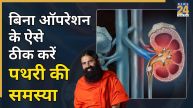 Baba Ramdev Kidney Stone Treatment