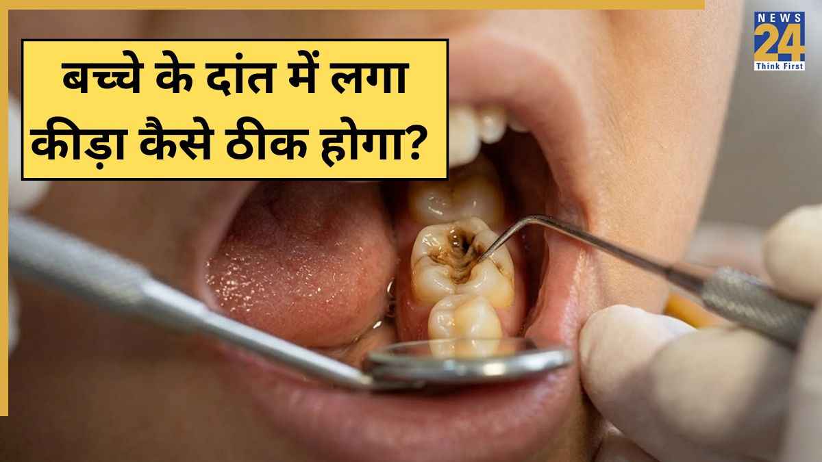 Bache Ke Dant Me Kida