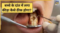 Bache Ke Dant Me Kida